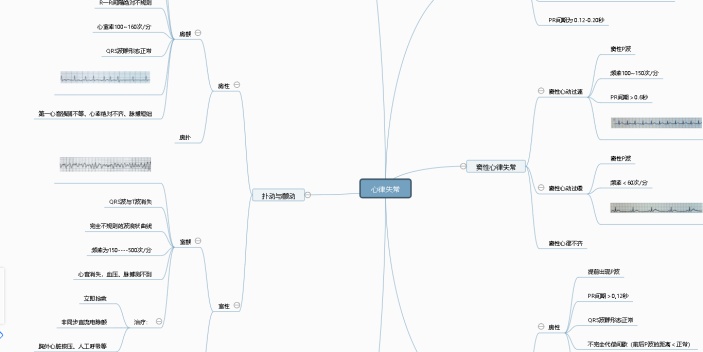 医学——心律失常思维导图